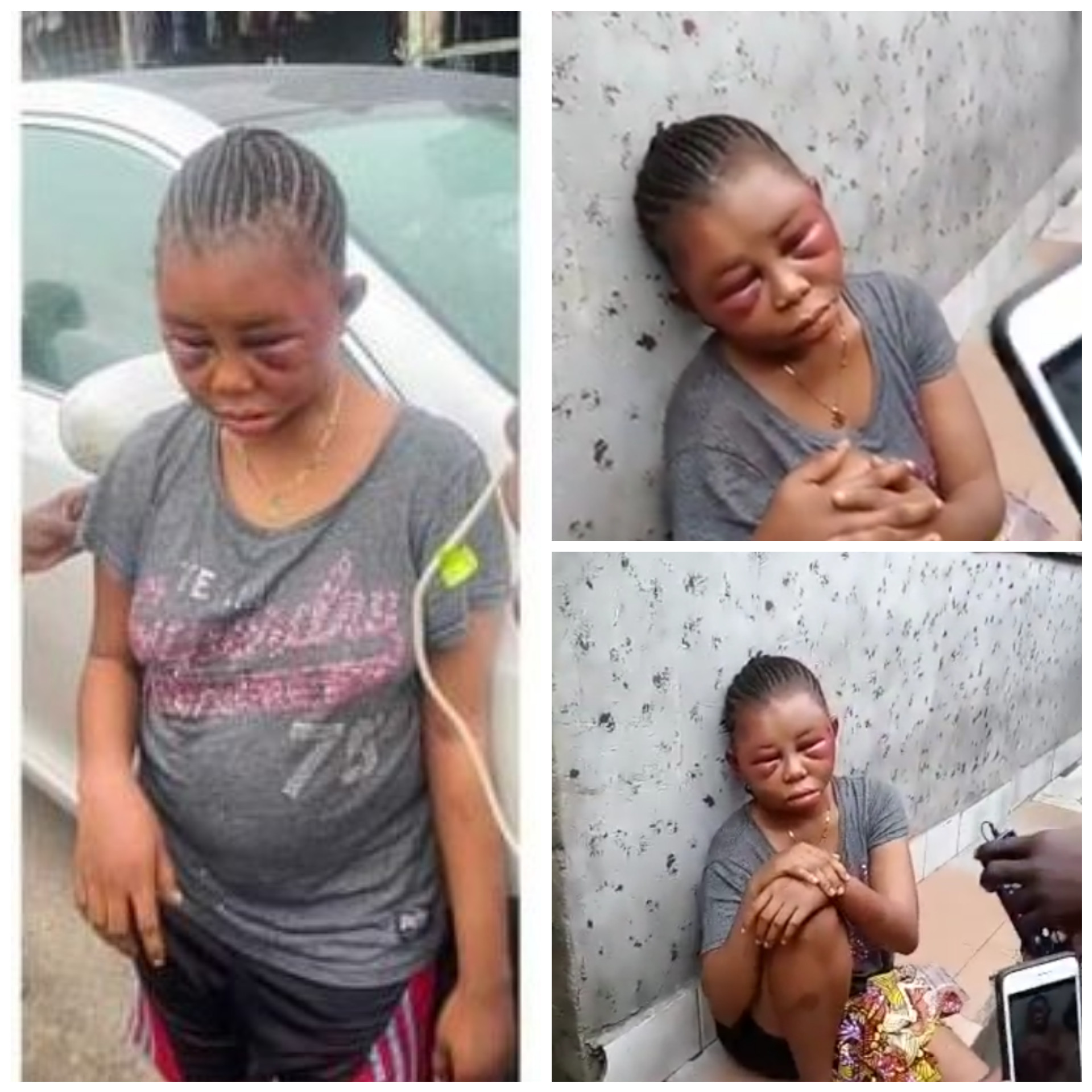 10-YEAR-OLD GIRL ALLEGEDLY BEATEN BY HER MADAM’S HUSBAND FOR BED-WETTING IN ABUJA AND 19-YEAR-OLD GIRL BEATEN TO PULP BY HER BOYFRIEND IN DELTA STATE (PHOTOS)