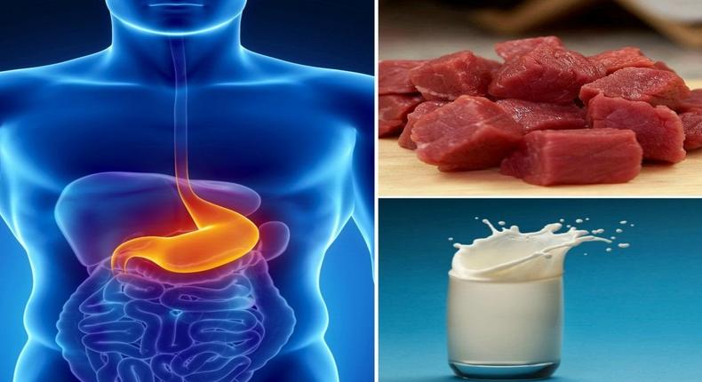 5 FOODS TO AVOID IF YOU HAVE STOMACH ULCER