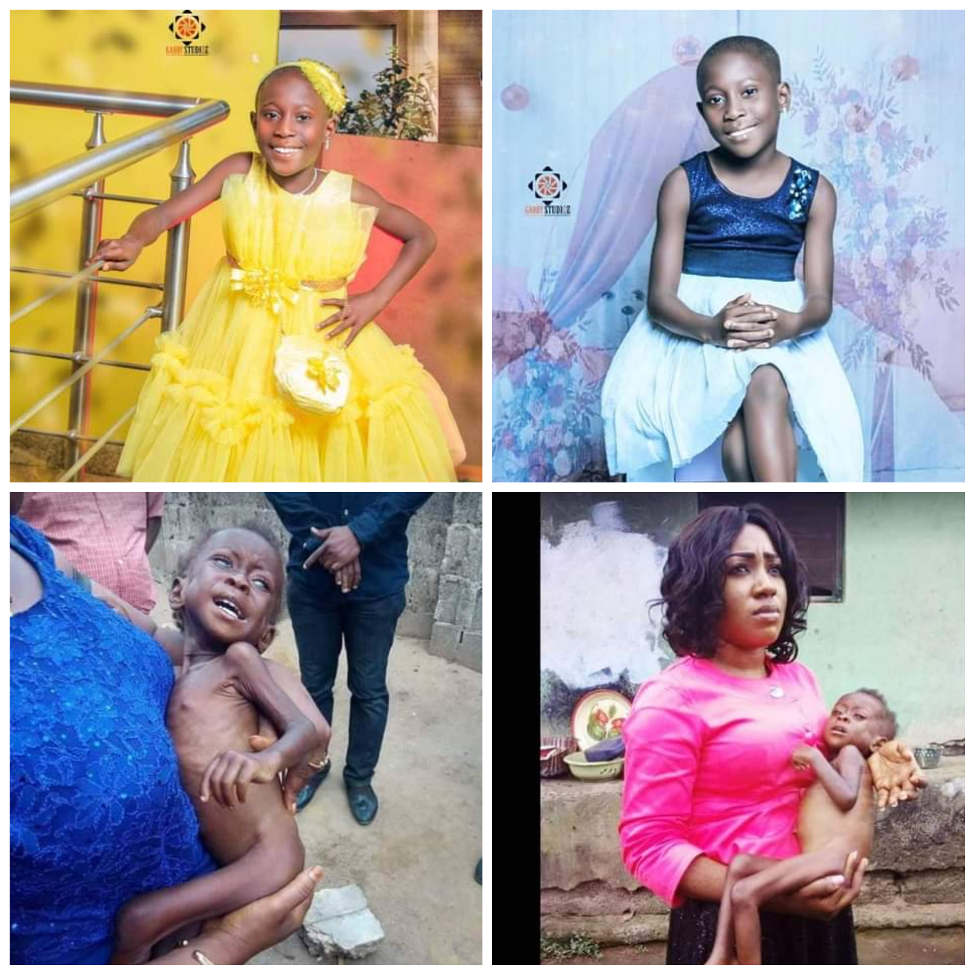 SEE NEW PHOTOS OF SEVERELY MALNOURISHED GIRL RESCUED IN CROSS RIVER 6 YEARS AGO