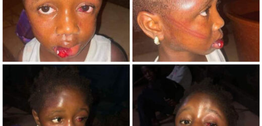 STARVING 5-YEAR-OLD GIRL MERCILESSLY BEATEN BY HER AUNT FOR TAKING FOOD FROM POT TO EAT