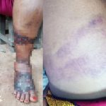 Nursing mother disfugured after she was allegedly brutalised by Special Anti Touting squad in Anambra