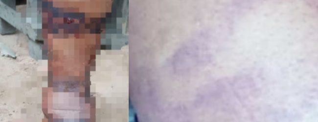 Nursing mother disfugured after she was allegedly brutalised by Special Anti Touting squad in Anambra