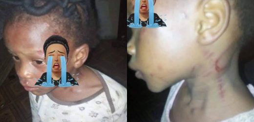 Girl left with welts after her mother allegedly b3,at her for not knowing how to count in Ondo state (photos)