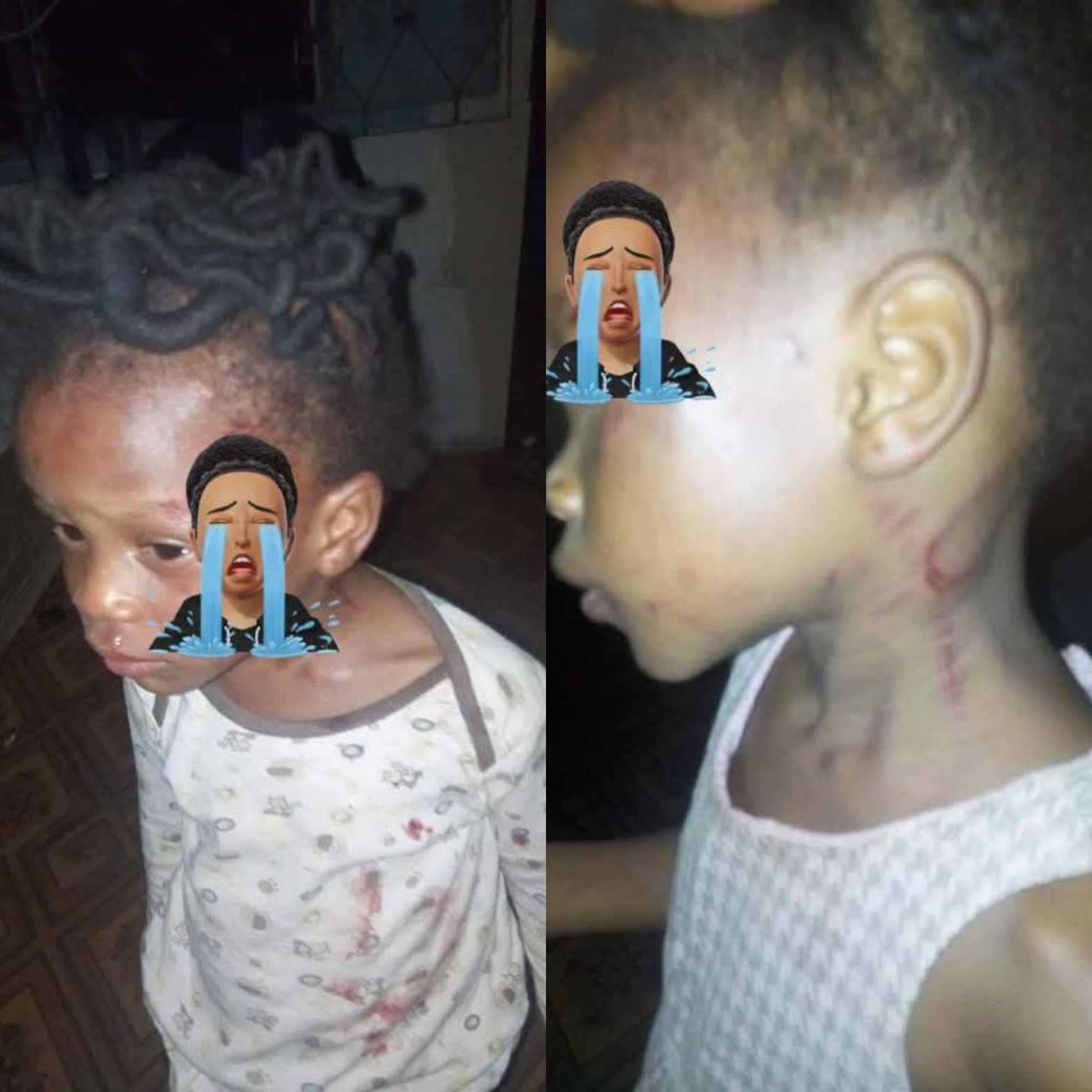 Girl left with welts after her mother allegedly b3,at her for not knowing how to count in Ondo state (photos)